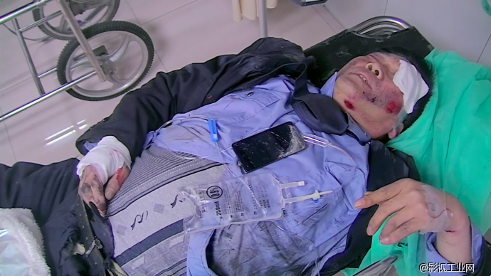 大叔骑电瓶车抢红灯 竟遭两车碾压命危 疯狂电瓶车为何管不住?